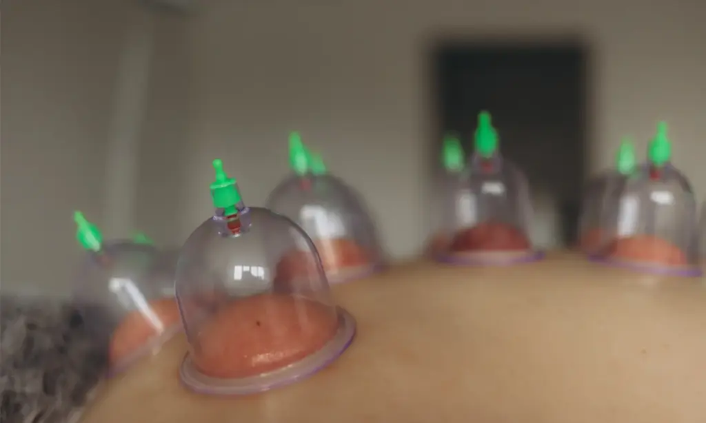 Hacamat malzemeleri kupa